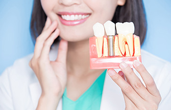Можно ли делать имплантацию зубов женщинам при месячных